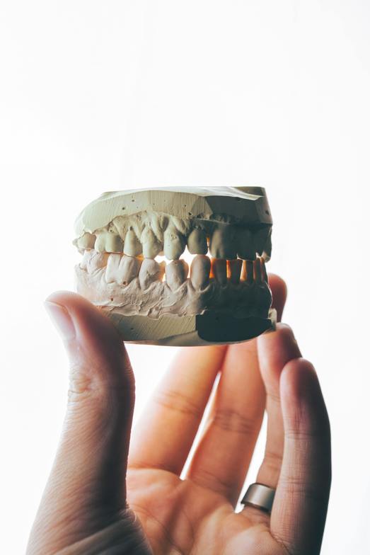 Model for chiropractic treatment of the TMJ