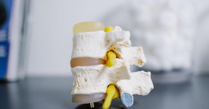 4 Ways To Prevent Neck Pain image