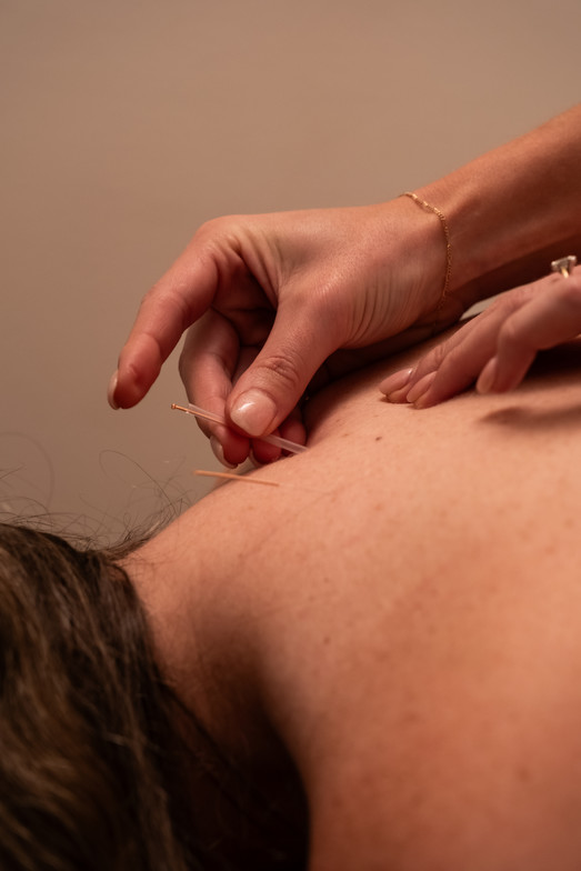 West Kelowna Acupuncture